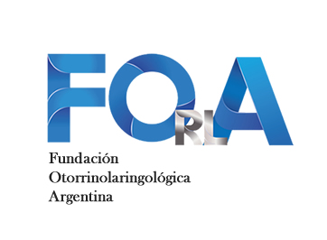 Forla
